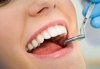 Dişeti Hastalıkları Tedavisi (Periodontoloji)